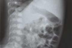 abdomen-radiografia-normal-1983-001