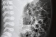 abdomen-radiografia-normal-1988-000