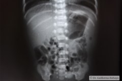 abdomen-radiografia-normal-1998-000