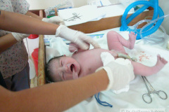 adaptacion-neonatal-secado-ligado-cordon-2005-000
