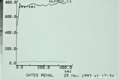 agenesia-renal-der-gamagrafia-renograma-1993-006