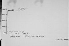 agenesia-renal-der-gamagrafia-renograma-1993-008