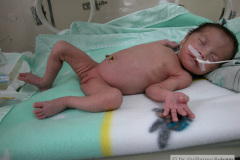 alimentacion-enteral-sog-2003-001