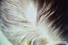 alopecia-areata-000