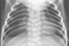 anomalia-vertebral-multiple-001