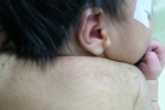 apendice-pre-auricular-der-2003-002