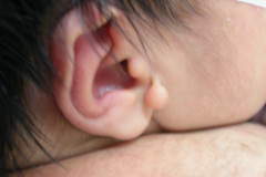 apendice-pre-auricular-der-2003-003