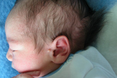 apendice-preauricular-bil-2004-001