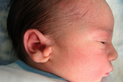 apendice-preauricular-bil-2004-003