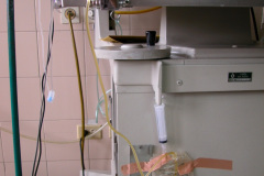 ascitis-puncion-denaje-hidrocele-edema-prepucio-2002-005