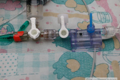 ascitis-puncion-denaje-hidrocele-edema-prepucio-2002-009