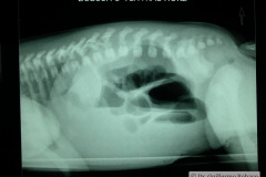 atresia-ileon-4d-2005-009
