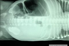 atresia-ileon-distension-decubito-lat-dren-y-cateter-femoral-2005-002