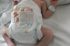 atresia-ileon-evisceracion-ileostomia-12d-2005-003