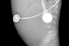 ausencia-gas-abdominal-intestino-paralitico-000