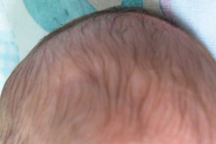 cabello-pretermino-2002-000