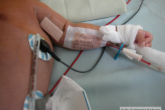 cateter-arterial-humeral-izq-000