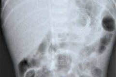 cateter-venoso-femoral-central-1999-000