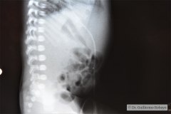 cateter-venoso-umbilical-curso-normal-002