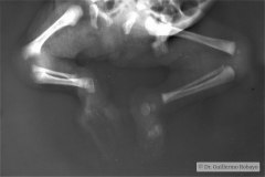 cerebro-costo-mandibular-pterigios-multiples-001