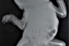 cerebro-costo-mandibular-pterigios-multiples-002