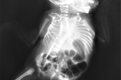 cerebro-costo-mandibular-pterigios-multiples-013