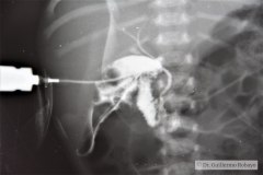 colangiografia-ictericia-directa-1987-001