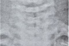 columna-cervical-normal-1996-000
