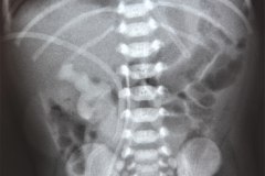 cordon-umbilical-silueta-o-sombra-000
