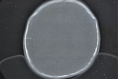 crouzon-tac-1997-010