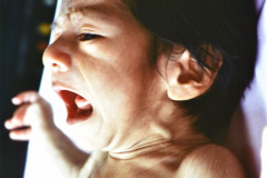 desnutricion-1m-1991-001