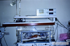 down-pancreas-anular-obstruccion-duodenal-signo-doble-burbuja-postop-sonda-duodenostomia-fototerapia-criolla-004