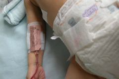 ductus-arterial-postop-tubo-torax-1m-13d-2003-002