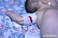 ductus-arterioso-postop-cateter-arterial-axilar-venoso-yugular-tubo-torax-tubo-orotraqueal-sog-000