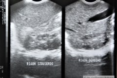 ecografia-abdominal-normal-1996-001