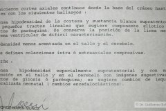 encefalopatia-hipoxico-isquemica-ehi-degeneracion-encefaloclastica-quistica-tac-2005-002