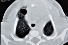 enfermedad-adenomatoidea-quistica-pulmonar-izq-tac-1997-006