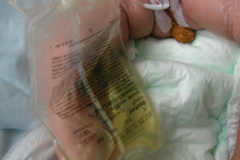estado-vejetativo-encefalopatia-hipoxica-1m-2003-001