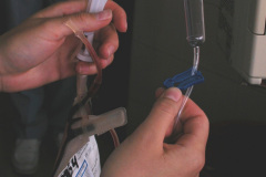 exanguinotransfusion-con-bombas-2002-009