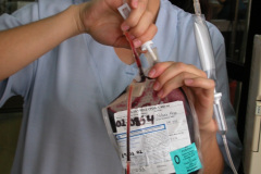 exanguinotransfusion-con-bombas-2002-013