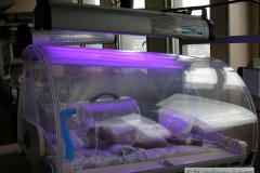 fototerapia-luz-azul-2002-000