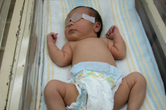 fototerapia-neonato-oclusion-ocular-criolla-2003-000