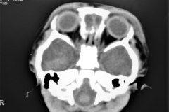 fractura-craneo-levantamiento-parietal-izq-cefalohematoma-1997-012