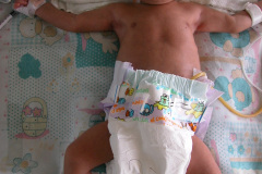 gastrostomia-2002-000