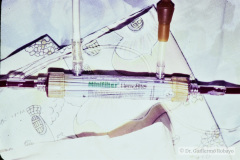 hemodiafiltracion-15-d-1994_03_17-h-blanca-vizcaya-000