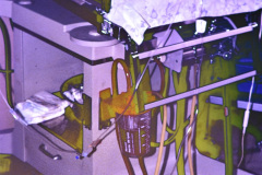 hemodiafiltracion-15-d-1994_03_17-h-blanca-vizcaya-002