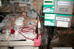 hemodiafiltracion-neonatal-2010-002
