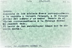 hipodactilia-234-dedos-mano-izq-agenesia-e-hipoplasia-falanges-1993-000
