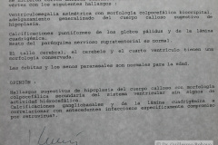hipoplasia-cuerpo-calloso-colpocefalia-calcificacion-gangliobasal-2006-028