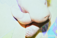 hipoplasia-femur-luxacion-de-rodillas-013